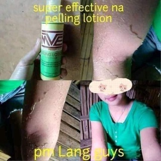 mve peeling lotion