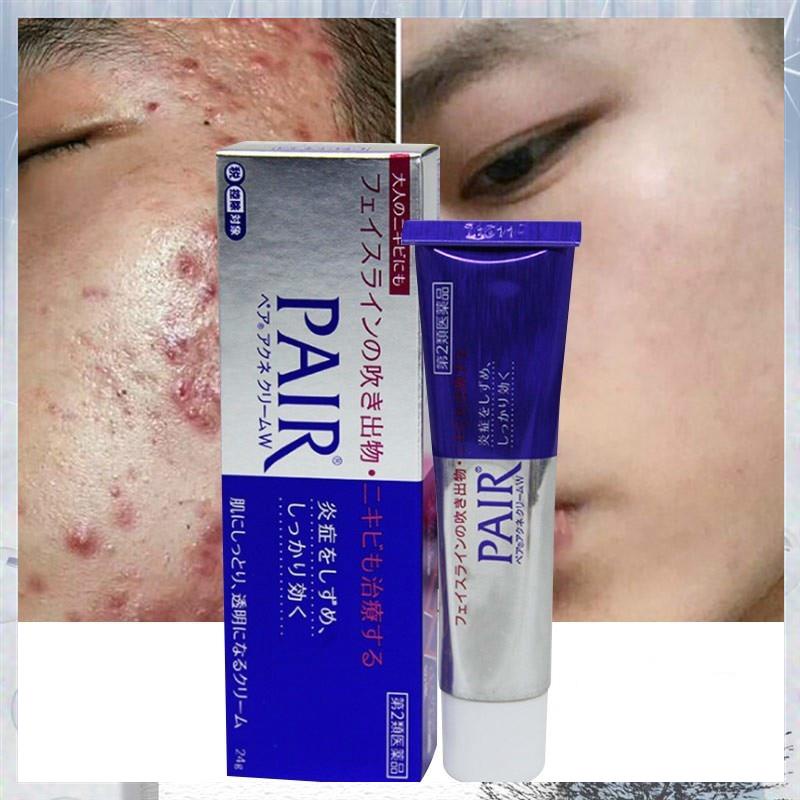 Available Original 24g Japan Lion Pair Acne Cream Anti Acne Cream On The Face For Acne Pimple Treat Shopee Philippines