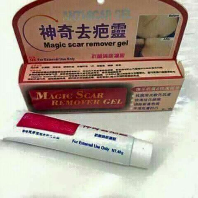 MAGIC SCAR REMOVAL CREAM Shopee Philippines
