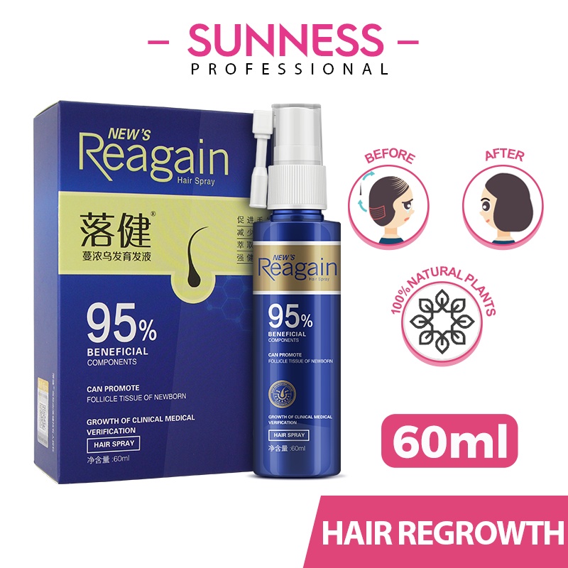 Sunness Minoxidill Upgraded Version Kopyrrol Regain Hair Growth Liquid  Nourishing | Shopee Philippines