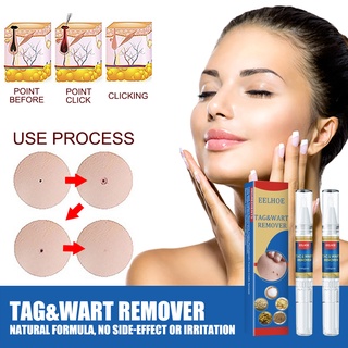 Skin Mole Removal Pen Remover Anti Verruca Remedy Liquid Pen Without Leaving Scars #4