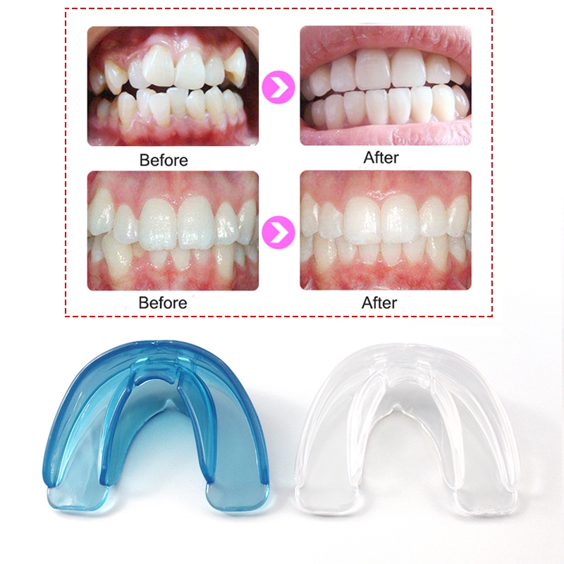orthodontic teeth alignment