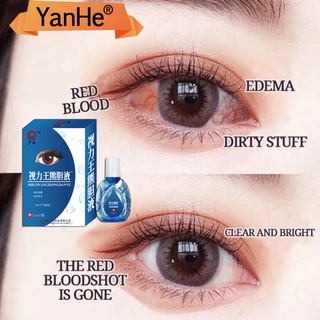【Spot goods】Eye Drops for Eye Care15ml/Brand Eye Drops/mineral eyedrops/Eye Drops Artificial Tears