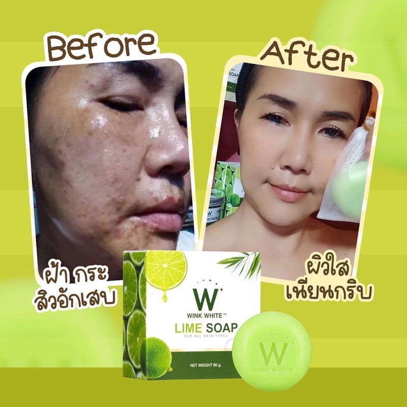 !!️ ่Wink White Lime Soap Lemon Win Gold Free Wink Accelerate Skin (1 Piece Size 80 G.)