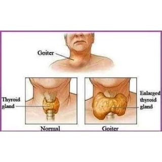 Guyabano Wine Health Supplements Prices And Online Deals Health Personal Care Sept 21 Shopee Philippines