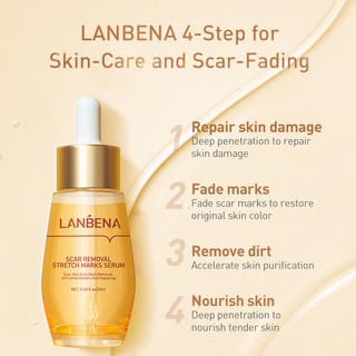 lanbena stretch mark removal