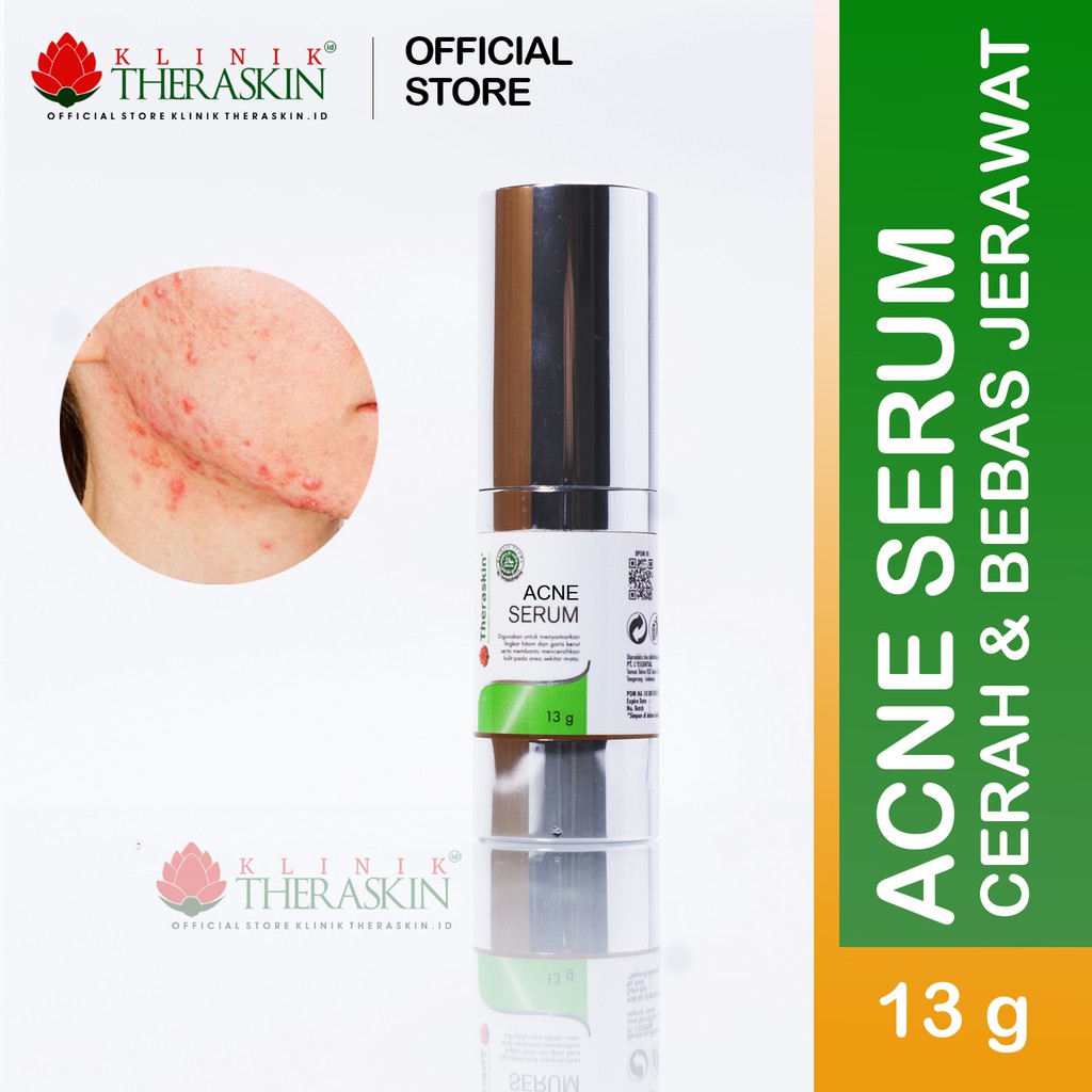 serum theraskin acne