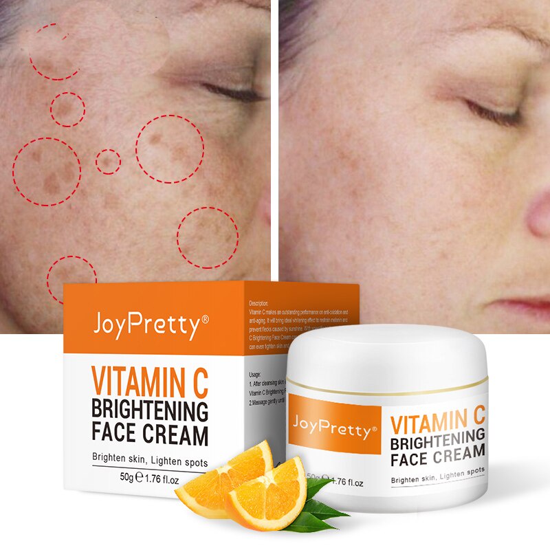 Vitamin C Collagen Cream Whitening Face Cream melasma cream Dark Spots Melanin Remover 50g