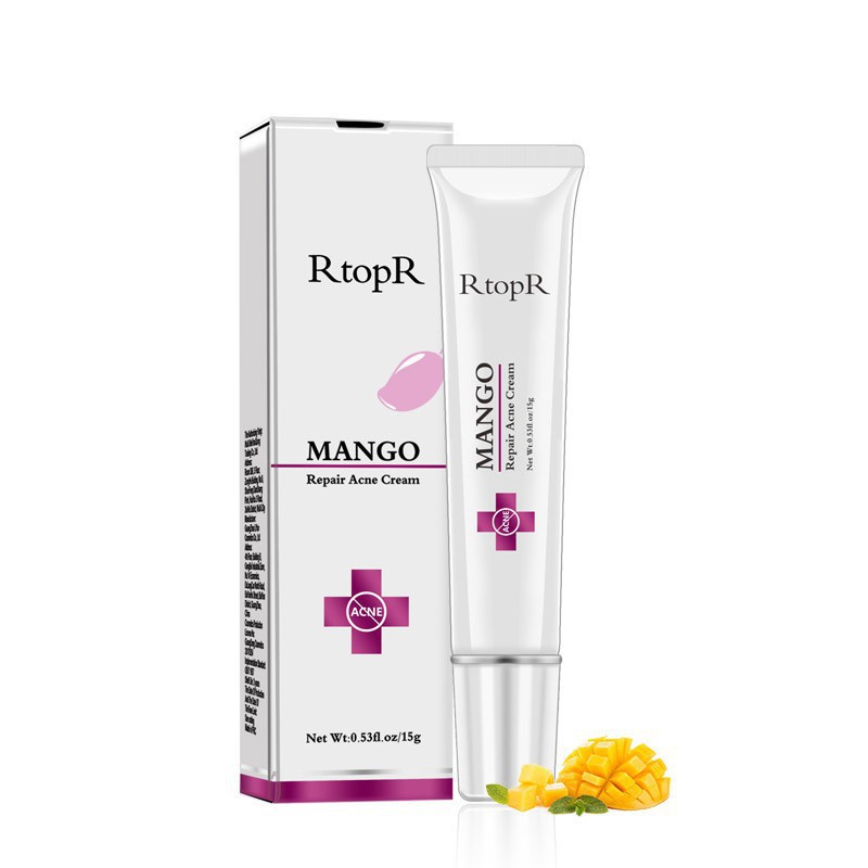 Mango Acne Cream Hydrating Control Oil Quickly Remove Pimples Shopee Philippines