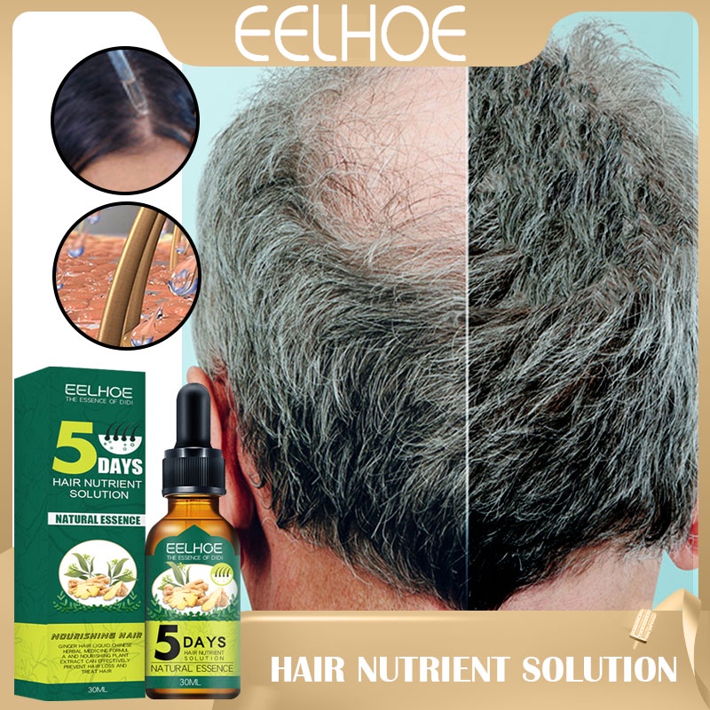 Eelhoe 5 Days Growth Ginger Hair Essence Nutrition Liquid Oil Treatment ...