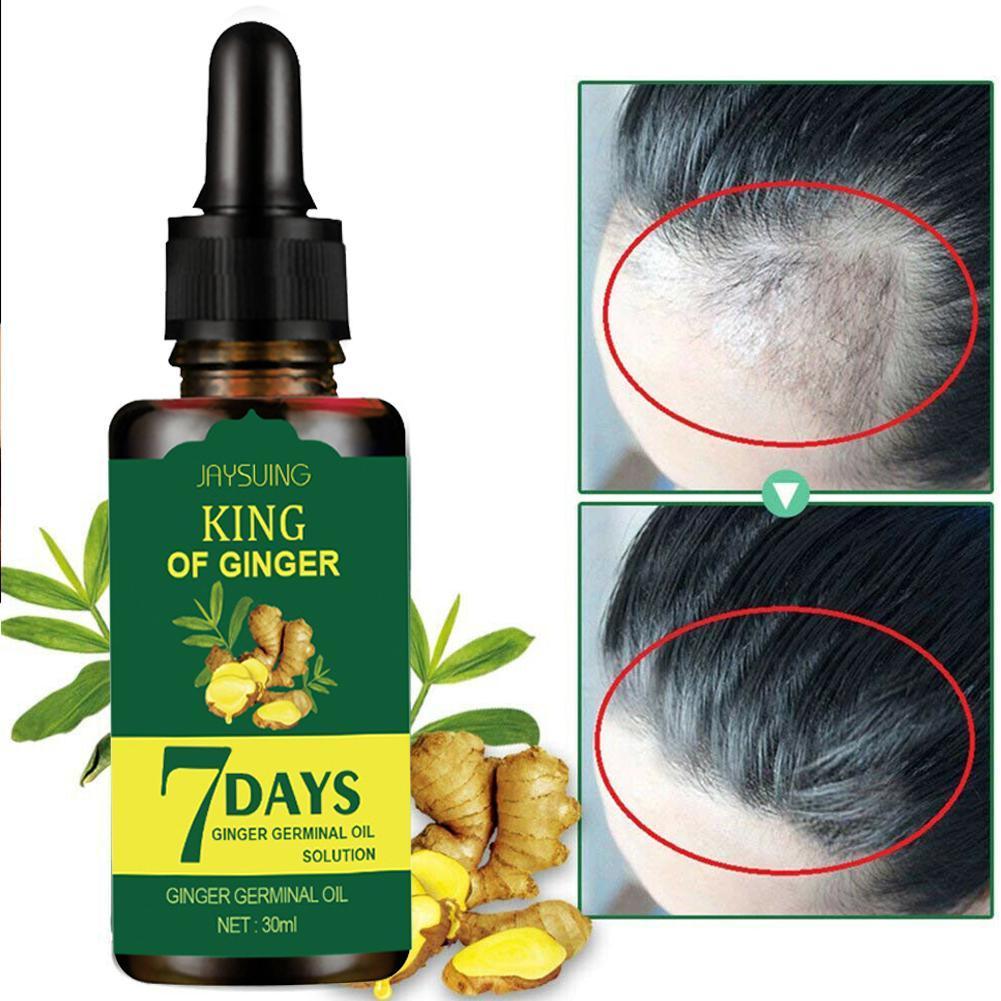 7 Days Hair Growth Products For Men Women Natural Treatment Grow Serum Oil  | Shopee Philippines