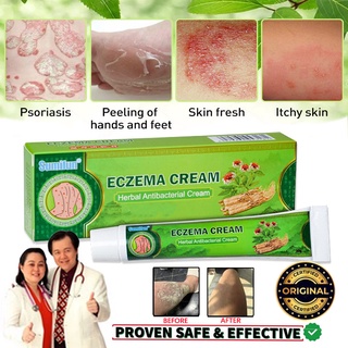 Eczema Cream Psoriasis Ointment Fast Relief Itchy Skin Allergy Antibacterial Cream 20g