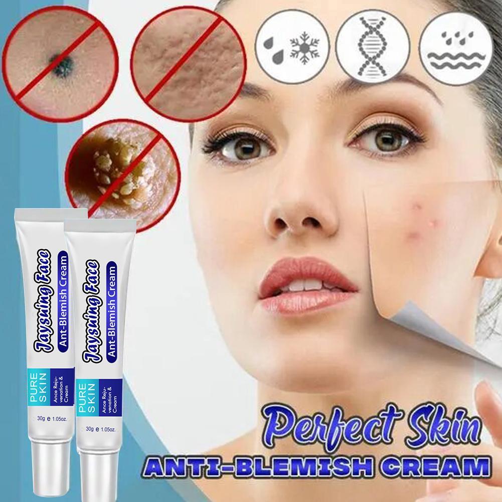 topical cream for pimples