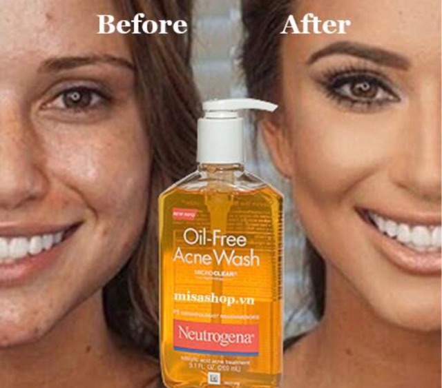 neutrogena face wash before and after