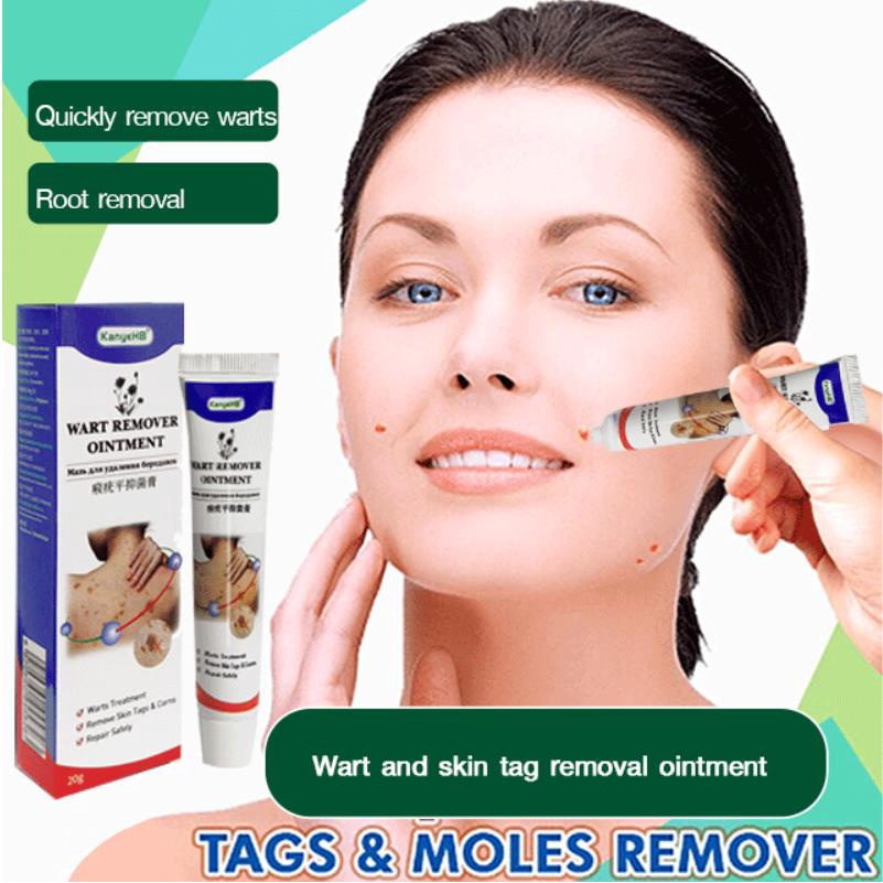 Wart and skin tag removal ointment wart removal cream Remove meat ...