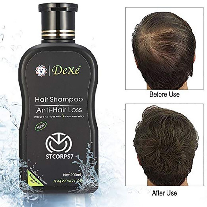 Hair Loss Conditioner Boosts Hair Growth Stimulates Regrowth