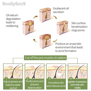 【Factory price】▧VIBRANT GLAMOUR Tea Tree Oil Acne Pimples Scars Treatment Facial Toner 30ml #2