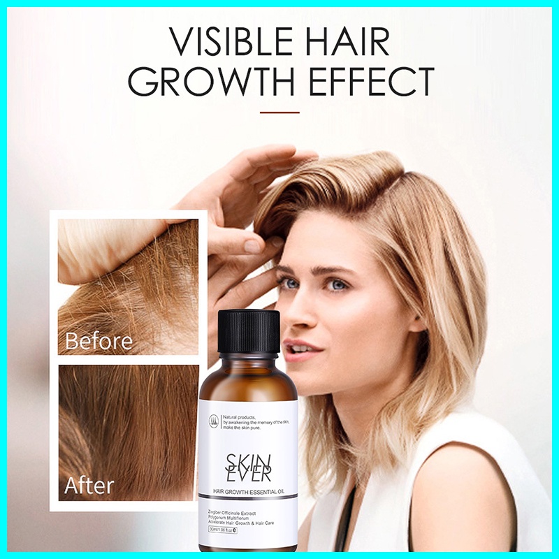 Effective Skin Ever Hair Growth Essential Oil Anti Hair Loss Nourish Roots  Hair Care | Shopee Philippines