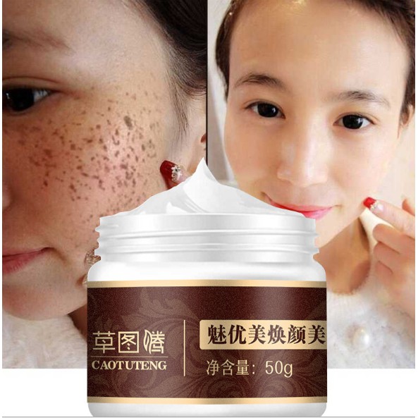 medicine cream for dark spots