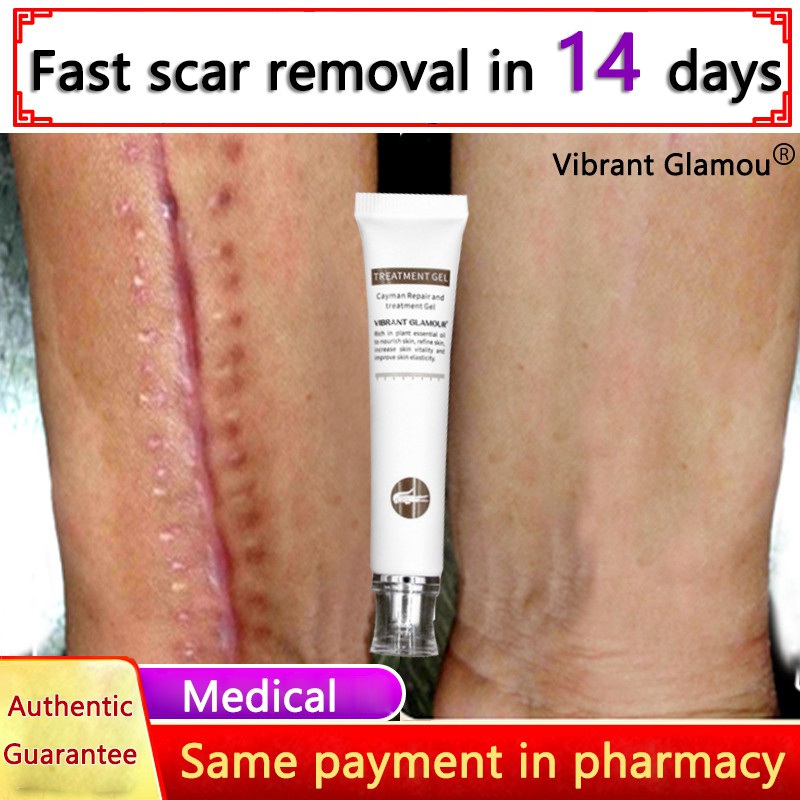 scar removal cream pharmacy