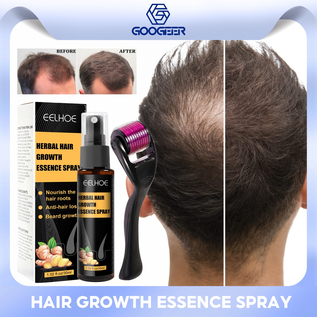 Advanced Regrowth Treatment Kit (30 Ml X 2) – Haarwachstums-Serum & Roller Gegen Haarausfall, Mit Natürlichen Inhaltsstoffen
