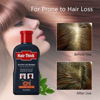 Dexe Hair Thick Anti Hairloss Shampoo C1 200ml Shopee Philippines