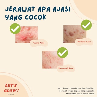 Microneedle ACNE PIMPLE PATCH PREMIUM #5
