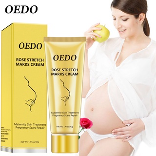 OEDO Rose Remove Stretch Marks Cream Anti Wrinkle Anti Aging Maternity Skin Repair Remove Pregnancy Scars Treatment Body Skin Care 40g #7