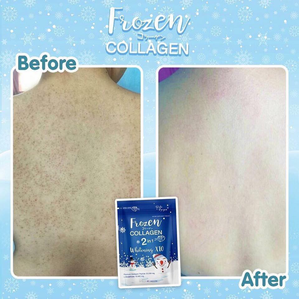 Unduh 940 Gambar Frozen Collagen Paling Baru HD