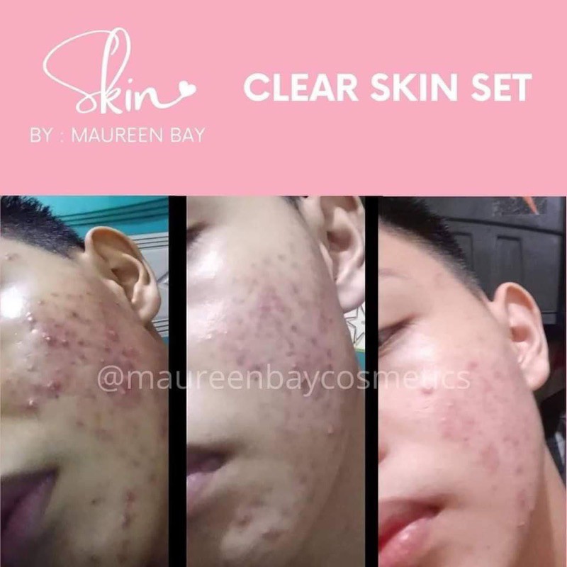 MAUREEN BAY CLEAR SKINCARE SET Shopee Philippines