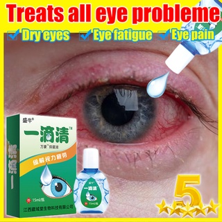 Eye Drops Relieve Dry Eyes And Swelling And Relieve Fatigue And Blurred Visual 15ML