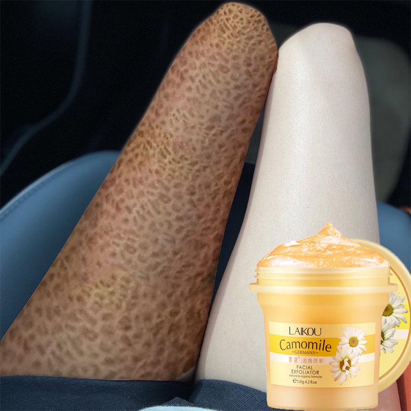 Scrub Whitening Exfoliating Chicken Skin Moisturizing Quick Bleach Softening Body Scrub 250g