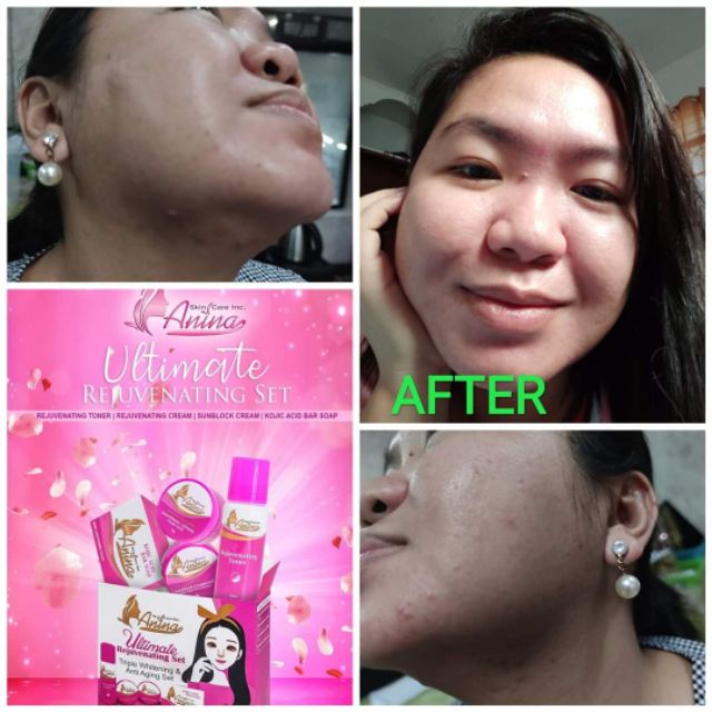 toner to use with differin