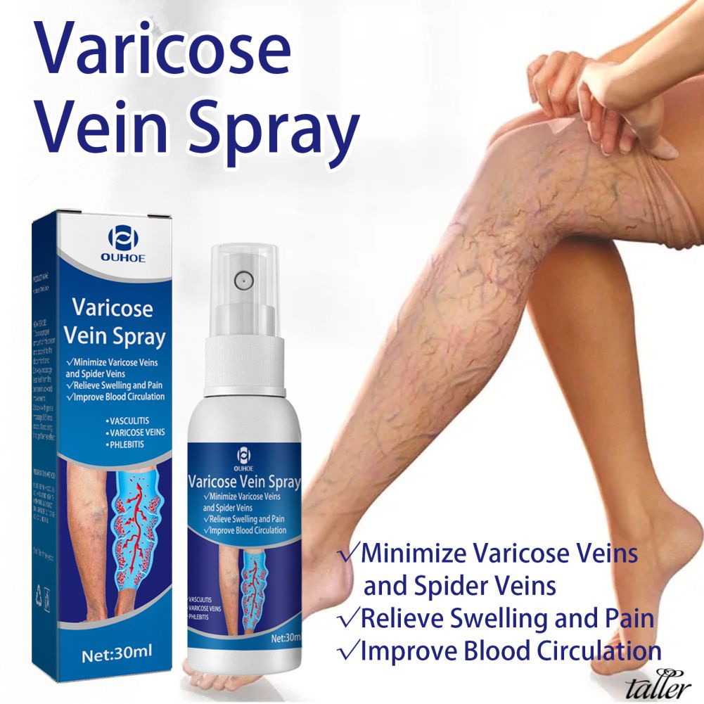 Varicose Vein Spray Repair Leg Blood Vessels Bulge Swelling Earthworm ...