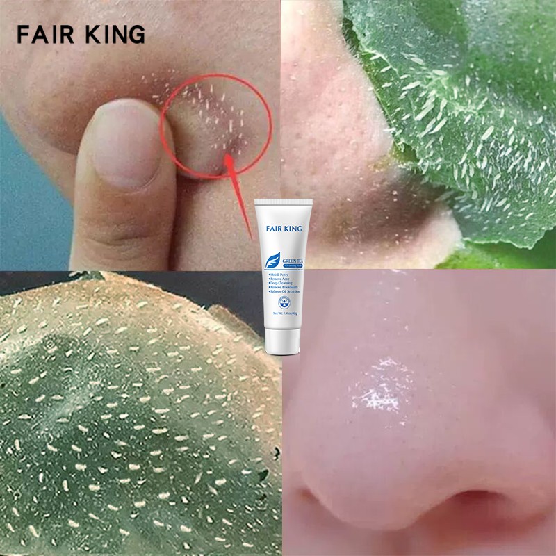 FAIR KING Blackhead Remover Mask Cream Peeling Off Acne Treatment Green