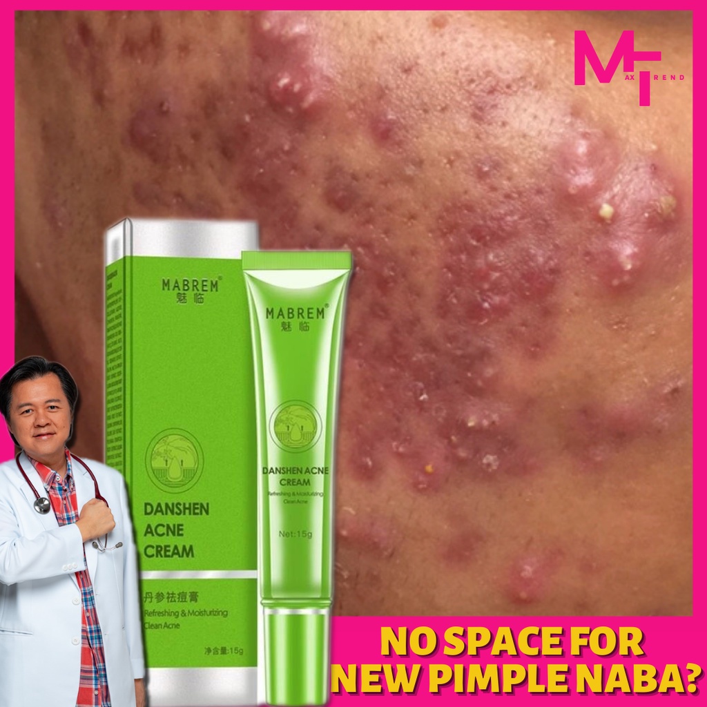 EFFECTIVE Acne TIGYAWAT Removal Cream Treatment Acne Scar Spots Oil