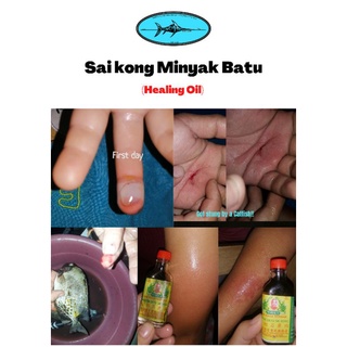 Minyak Batu Sai Kong 30/70 ml (For minor burns, scald, cut, sprain 