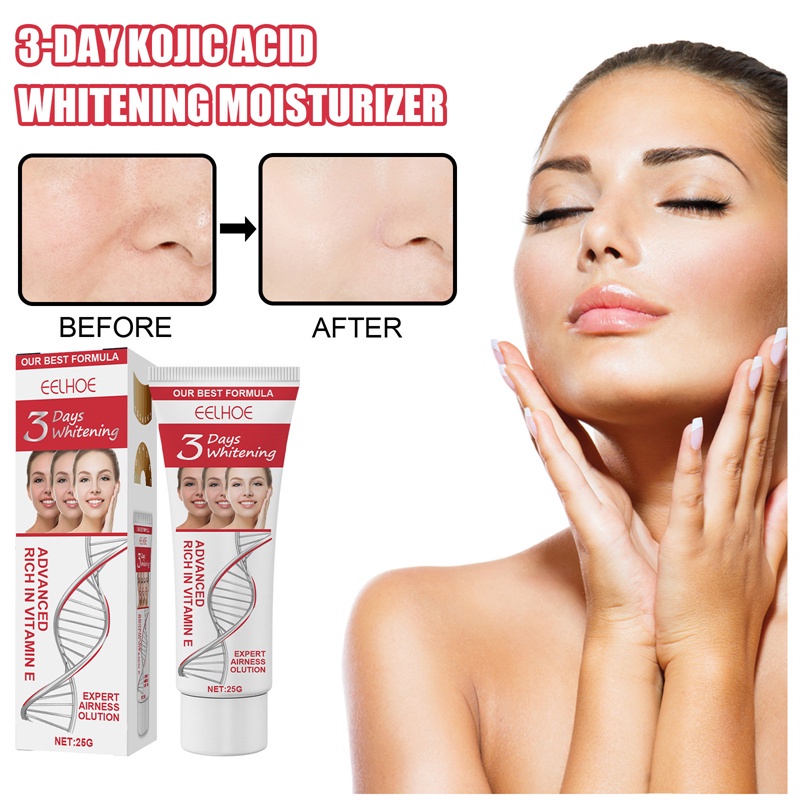 eelhoe Strong Whitening Freckle Cream Melasma Cream Remove Dark Spots Melanin Melasma Remover Brighten Skin Anti-Aging Skin Lightening | Shopee Philippines eelhoe Strong Whitening Freckle Cream Melasma Cream Remove Dark Spots Melanin Melasma Remover Brighten Skin Anti-Aging Skin Lightening | Shopee Philippines