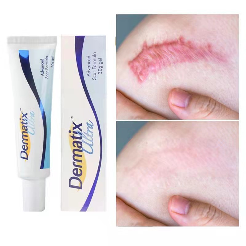 15g Dermatix Acne Scar Gel Pimples Stretch Marks Removal Cream