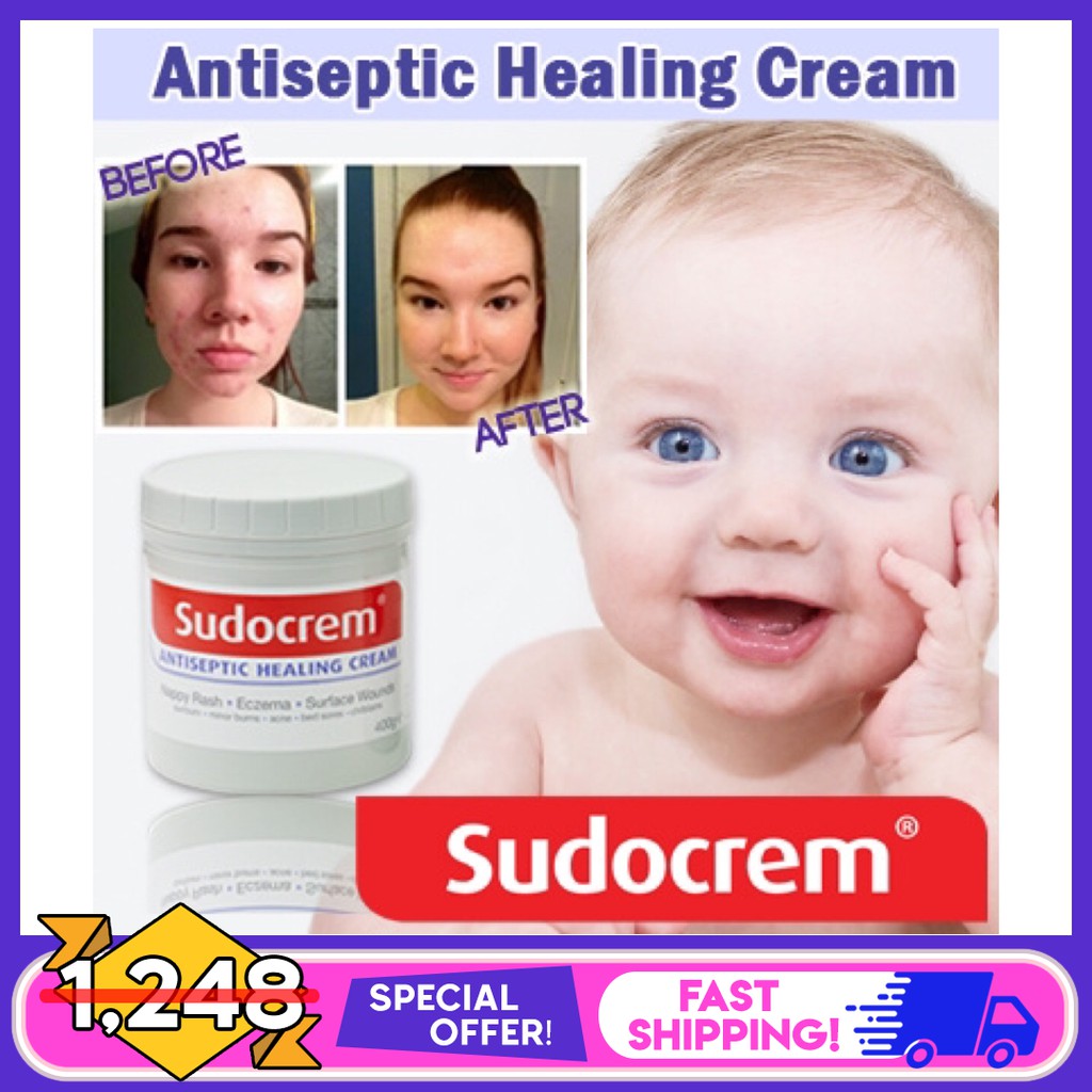 Sudocrem For Eczema Baby atelieryuwa.ciao.jp