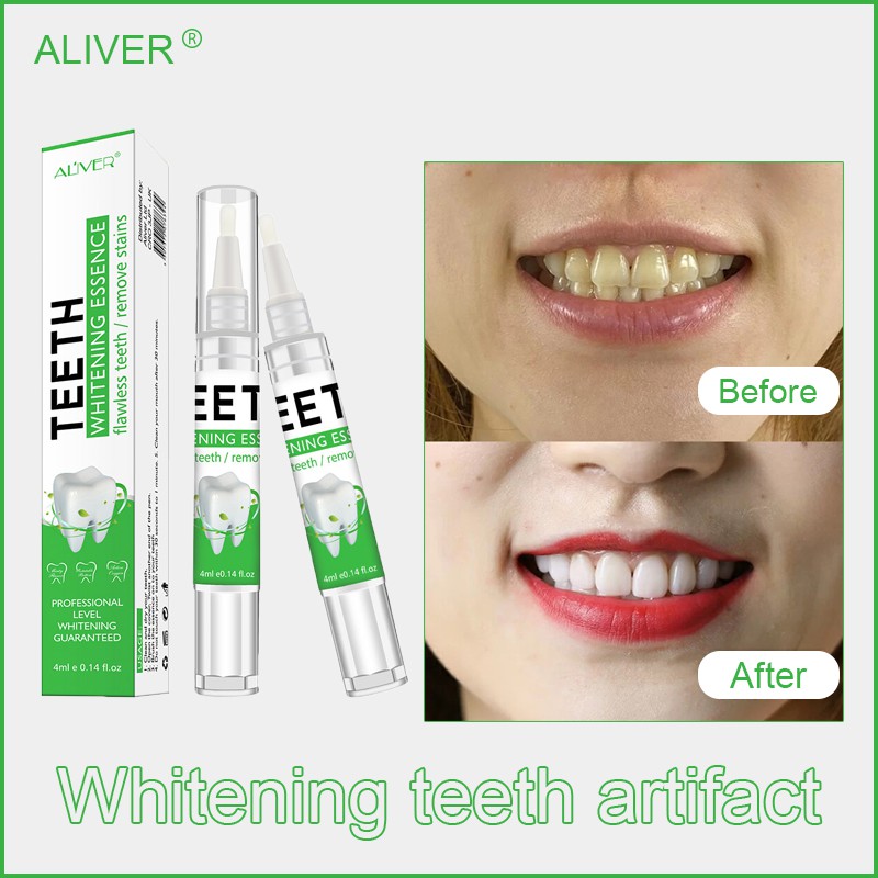 ALIVER teeth whitening artifact to remove yellow teeth and stains Oral