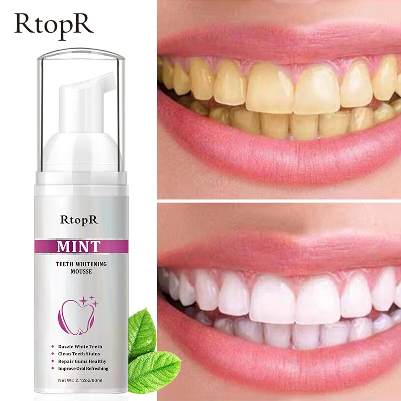 Ready Stock Teeth Whitening  Remove Smoke Stains Coffee Stains  Fresh Breath Bad Breath Clean Teeth Stains Dazzle White Teeth (P2B)