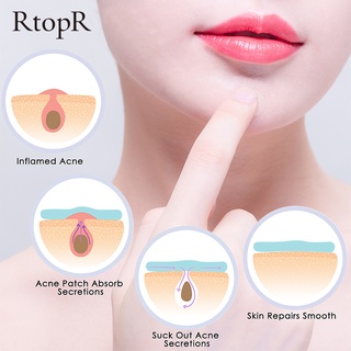 RtopR Acne Pimple Patch Invisible Acne Treatment Stickers Treatment Pimple Remover Tool Skin Care Waterproof 24 Patches Daily And Night Use #8