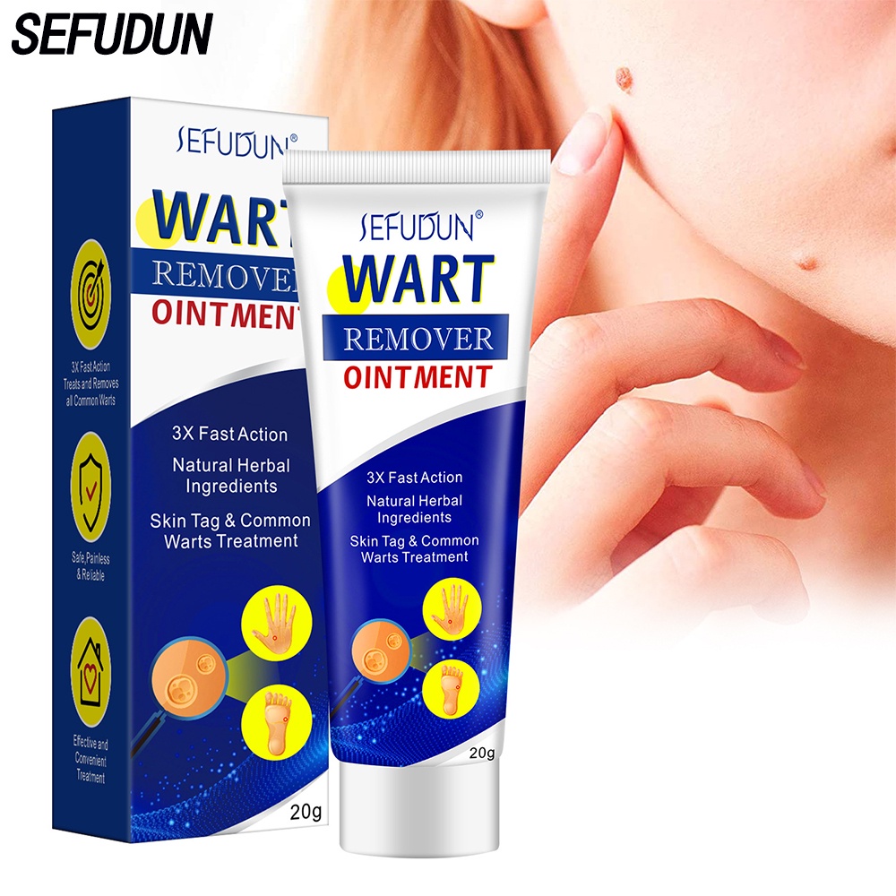 Sefudun Warts Remover Original Warts Remover Original Cream Skin Tag Remover Original Warts