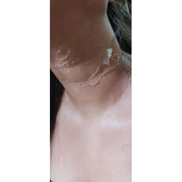 scd Peeling lotion 100ml