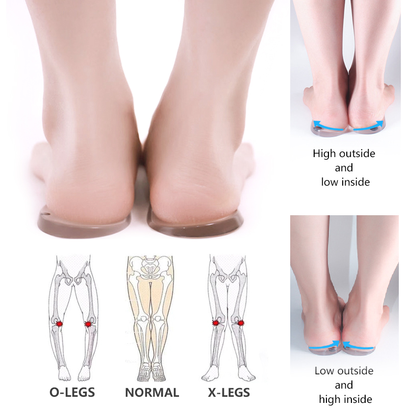 Schuh Massageeffekt Einlagen Atmungsaktive orthopädische Gel- Pads für Männer AIDUE Magnetische Einlegesohlen Anti-Fasciitis Entlasten Füße Schmerze Frauen
