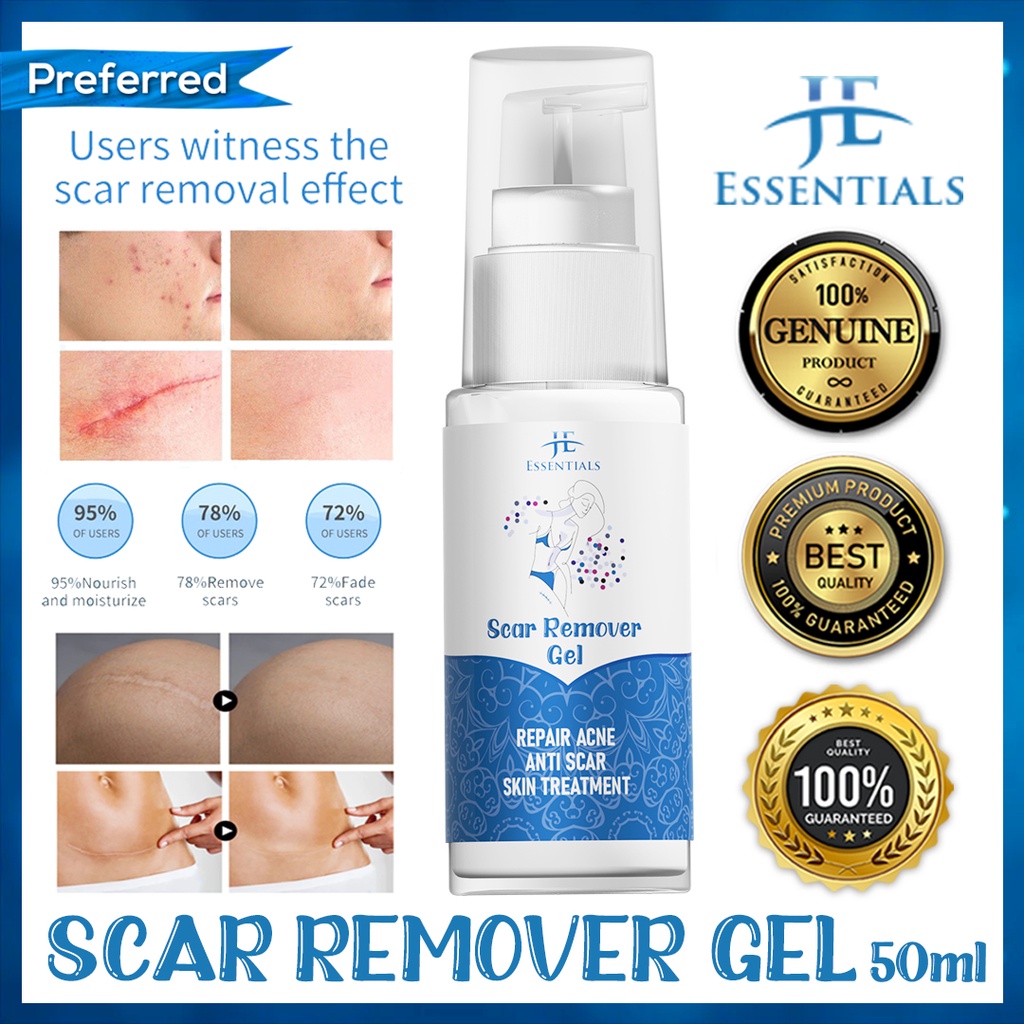 [essentials Scar Remover Gel] Stretch Marks Scar Remover Gel For Old 