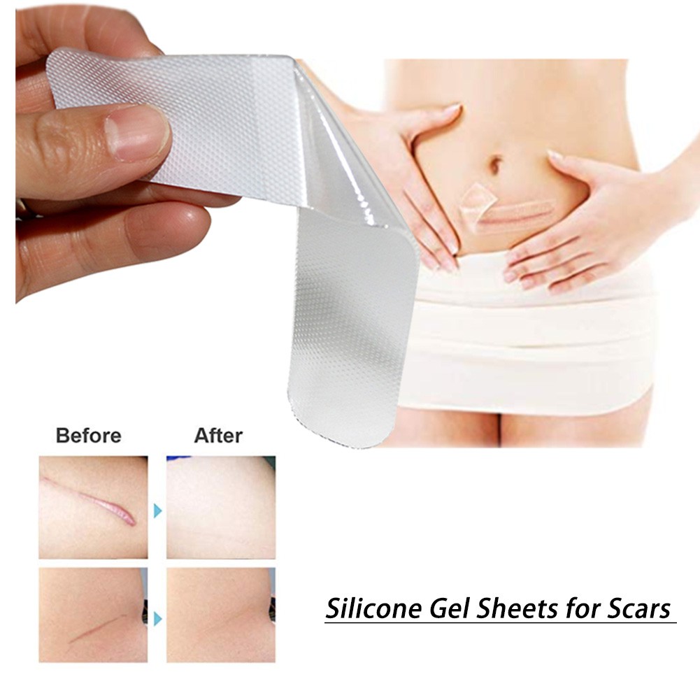 silicone gel sheets for scars