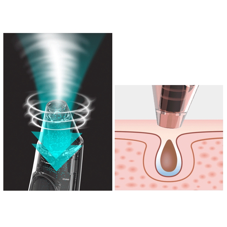 wellskins blackhead cleaner