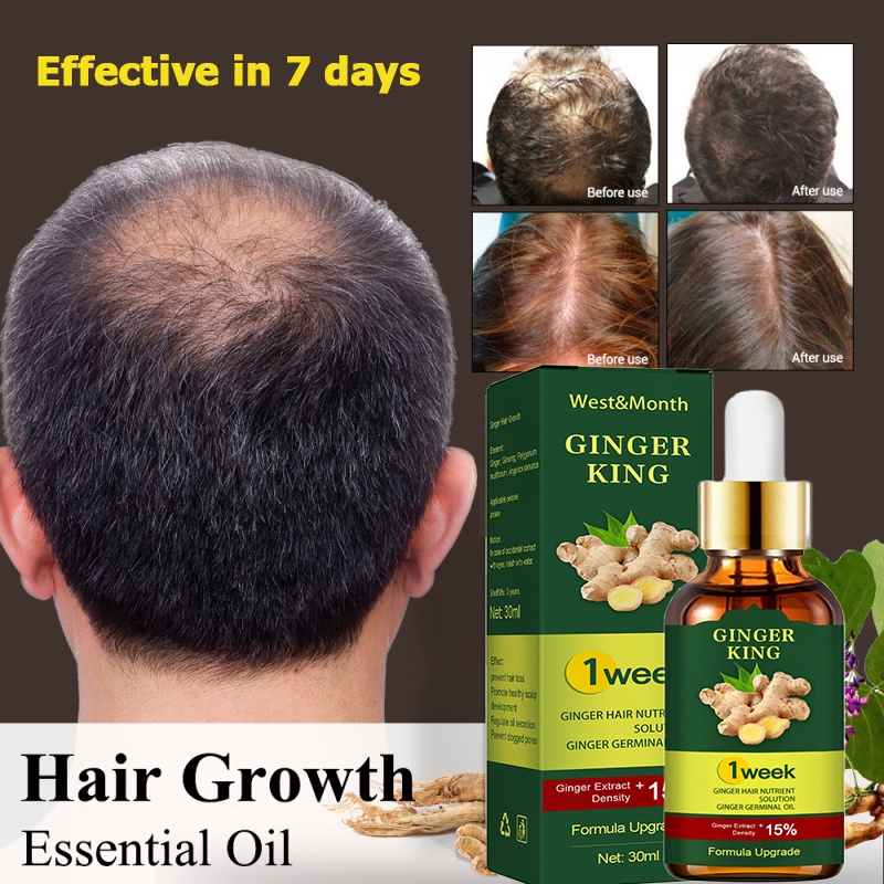 Ginger Hair Growth Serum Fast Hair Growth and Scalp Anti-Hair Loss ...